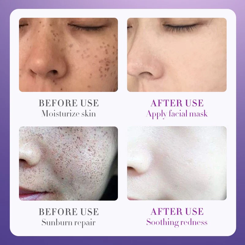 SADOER Nicotinamide Whitening Anti Freckle Moisturizing Toner 100ml - Image 5